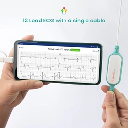 Pocket ECG with AI