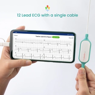 Pocket ECG with AI